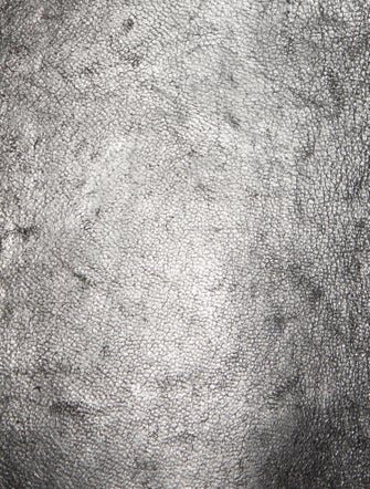 Chanel Caviar Medallion Tote