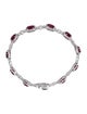 Aamiaa 14K Lab-Grown Diamond & Synthetic Ruby Link Bracelet